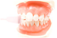 ここでは総入れ歯の種類をご紹介します