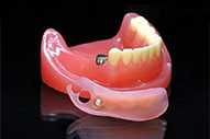 磁性アタッチメント義歯の特徴
